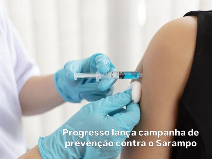 Prefeitura de Progresso alerta viajantes para vacinação contra o sarampo antes da Copa do Mundo
